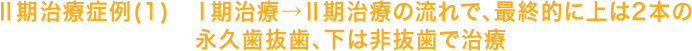 Ⅱ期治療症例(1)Ⅰ期治療→Ⅱ期治療の流れで、最終的に上は2本の永久歯抜歯、下は非抜歯で治療