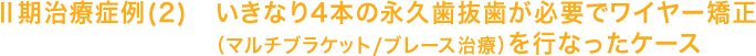 Ⅱ期治療症例(2)いきなり4本の永久歯抜歯が必要でワイヤー矯正（マルチブラケット/ブレース治療）を行なったケース