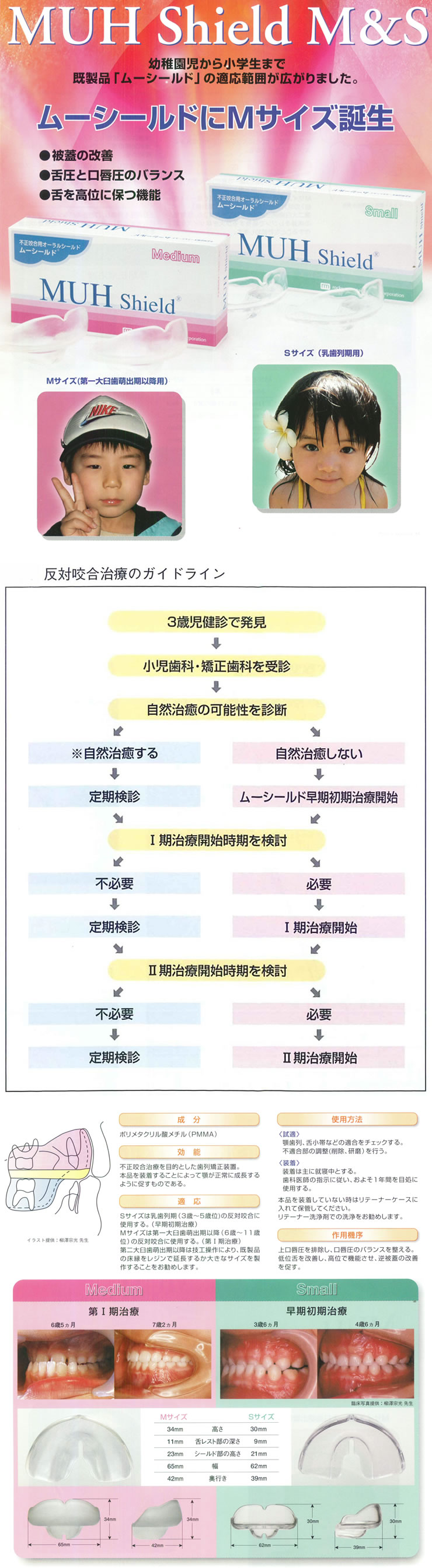 ムーシールド（反対咬合用オーラルシールド）1