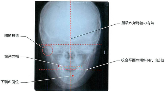 主として正貌セファロレントゲン（矯正専用）で確認している事項イメージ