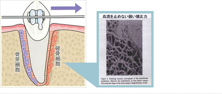 血液を止めない弱い強制力