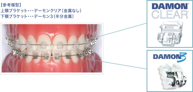 【参考模型】