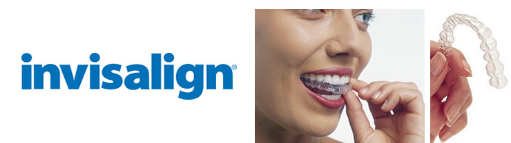 invisalign