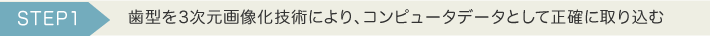歯型を3次元画像化技術により、コンピュータデータとして正確に取り込む