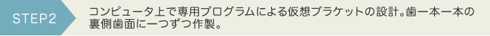 コンピュータ上で専用プログラムによる仮想ブラケットの設計。歯一本一本の裏側歯面に一つずつ作製。