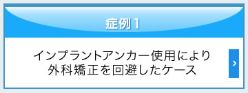 インプラントアンカー使用により外科矯正を回避したケース