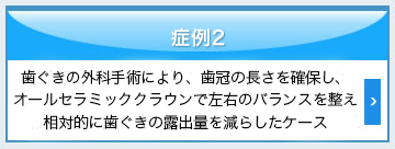 歯冠の長さを確保し、オールセラミッククラウンで左右のバランスを整え、相対的に歯ぐきの露出量を減らしたケース