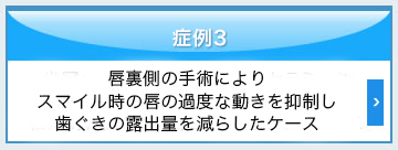 唇裏側の手術により、スマイル時の唇の過度な動きを抑制し、歯ぐきの露出量を減らしたケース