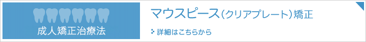 マウスピース（クリアプレート）矯正