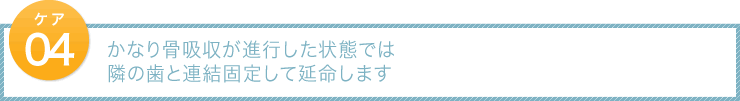 かなり骨吸収が進行した状態では隣の歯と連結固定して延命します