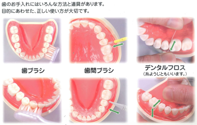 補助清掃道具イメージ