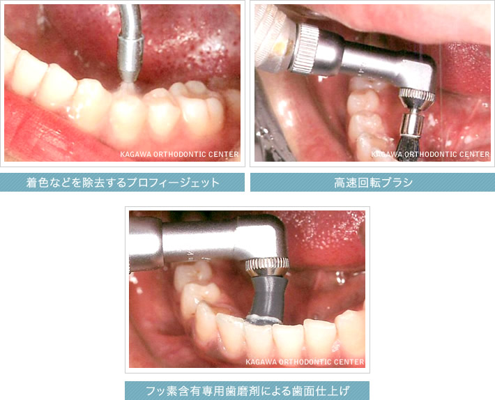 PMTCイメージ