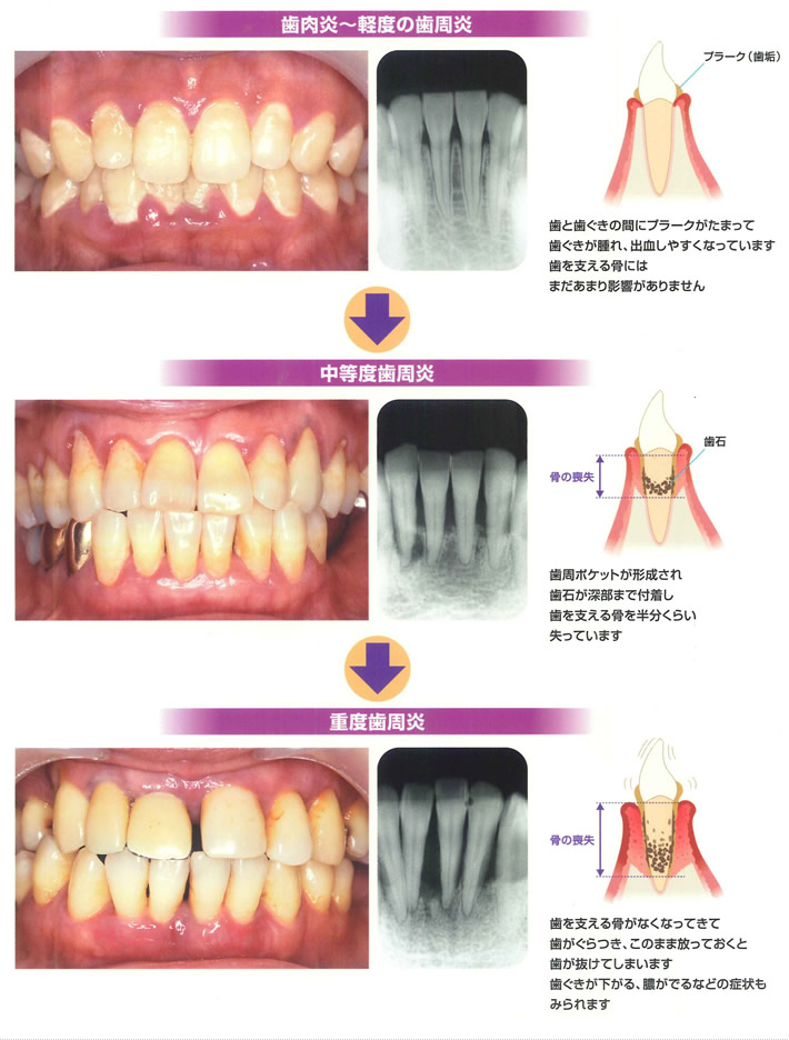 どのように進行するの？イメージ