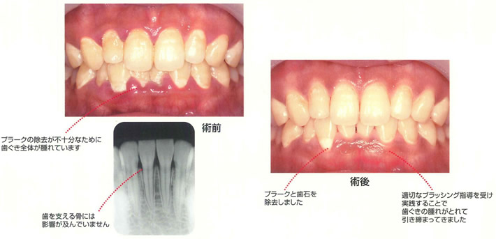 術前術後イメージ