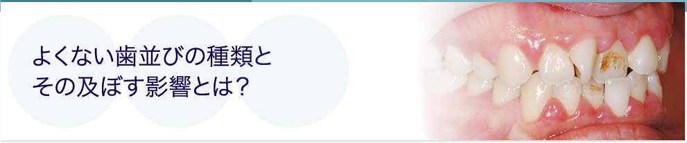 よくない歯並びの種類とその及ぼす影響とは？