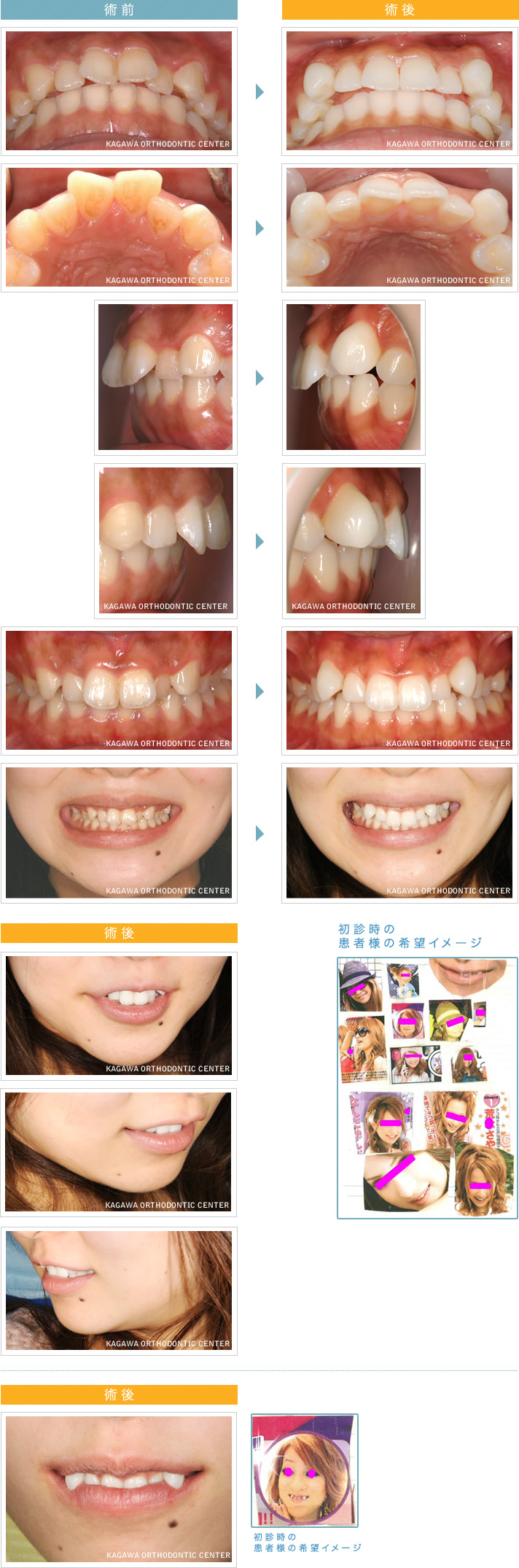 before ＆ after イメージ