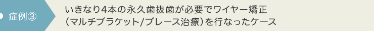 いきなり4本の永久歯抜歯が必要でワイヤー矯正