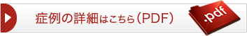 症例の詳細はこちら（PDF）